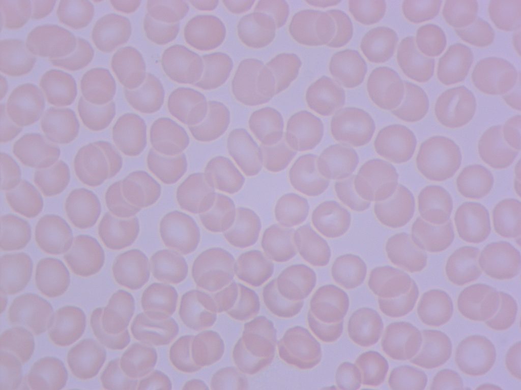 Canlı Su Nedir? 3 Suyu ictikten 20 dakika sonra