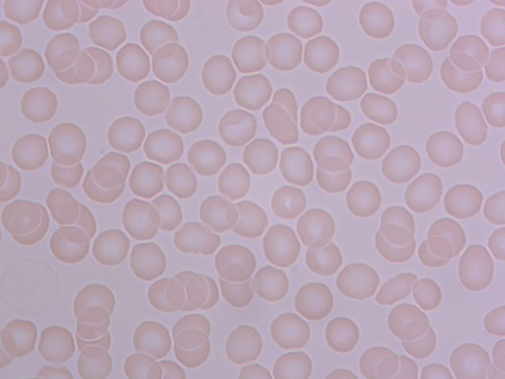 Canlı Su Nedir? 5 Canlı Su